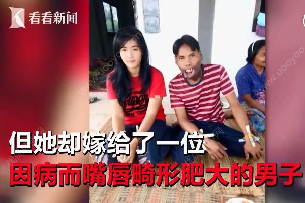 美女离婚改嫁畸形嘴丑男，前夫指责“她一定是为了钱”(2)