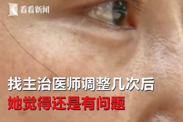 女子整容后一下子老了十多岁，医院称自己资质合法(4)