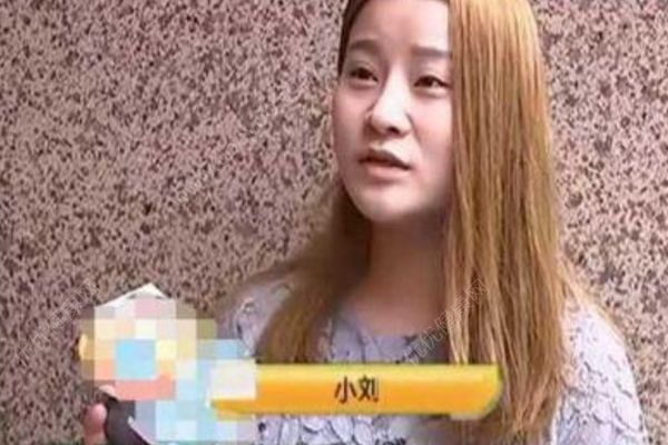 女子花5300元割双眼皮，3年后想退款：左眼是四眼皮(2)