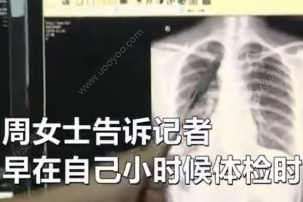 女子五脏六腑全长反，医生手术如做脑筋急转弯(2)