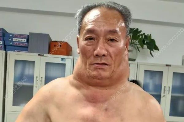 每天2斤白酒，脖子比腰粗，大爷喝酒55年成绿巨人(1)