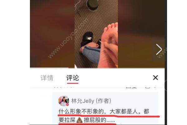 林允回应公开撕脚皮，“接地气”说辞遭群嘲(2)